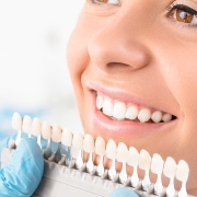 Teeth Whitening Services